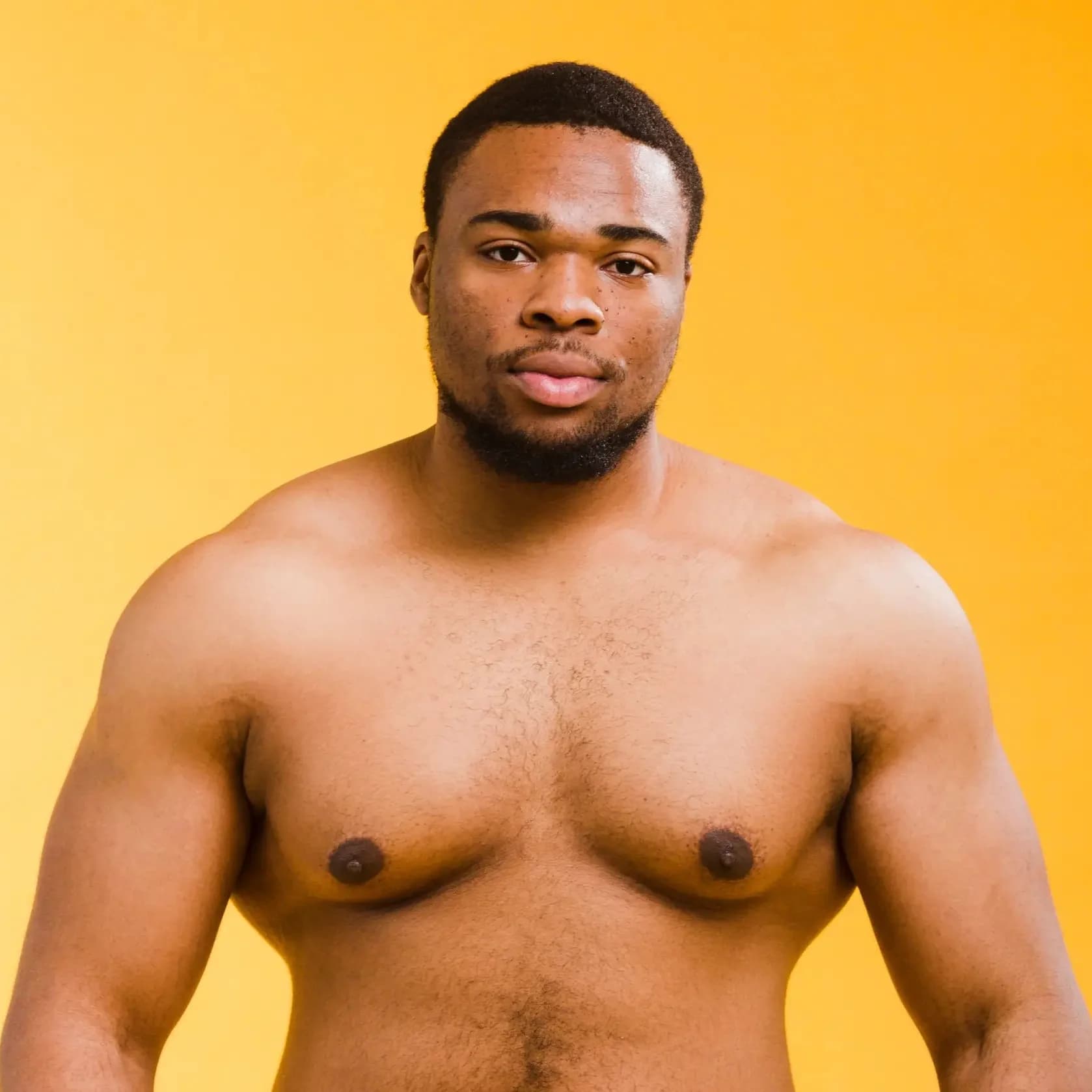 Gynecomastia