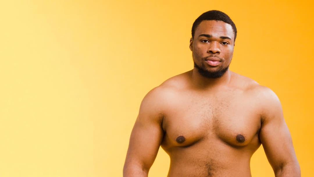 Gynecomastia