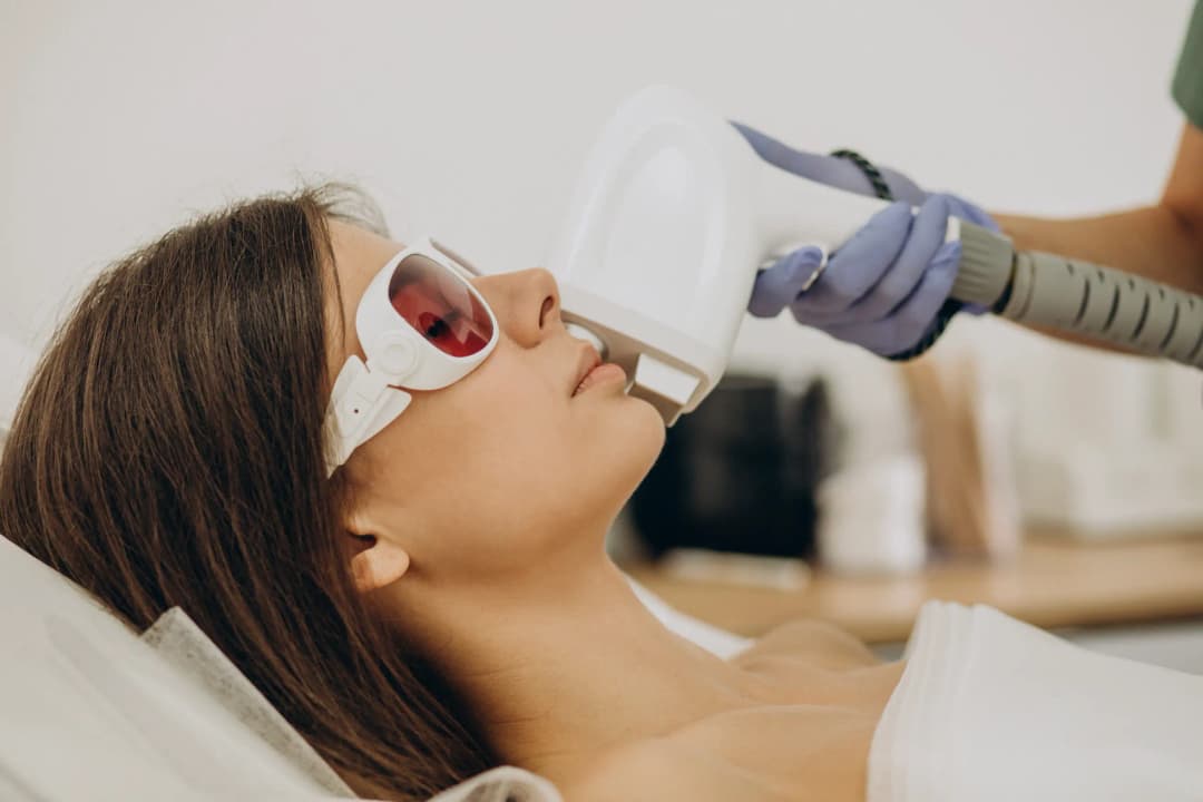 Laser hair removal