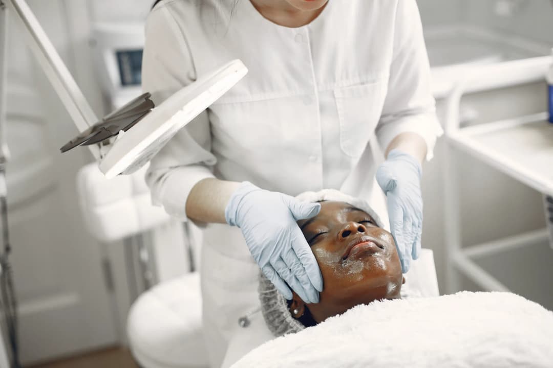Chemical peels