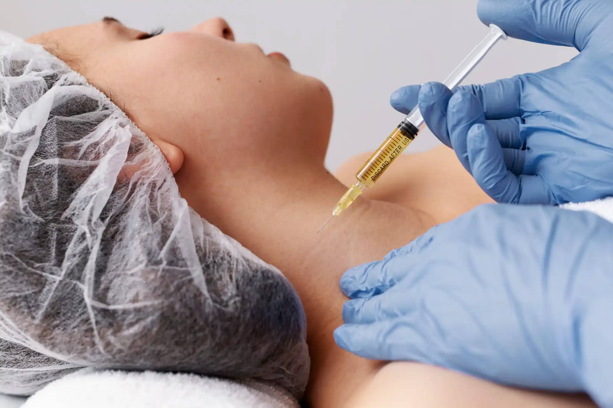 Platelet Rich Plasma